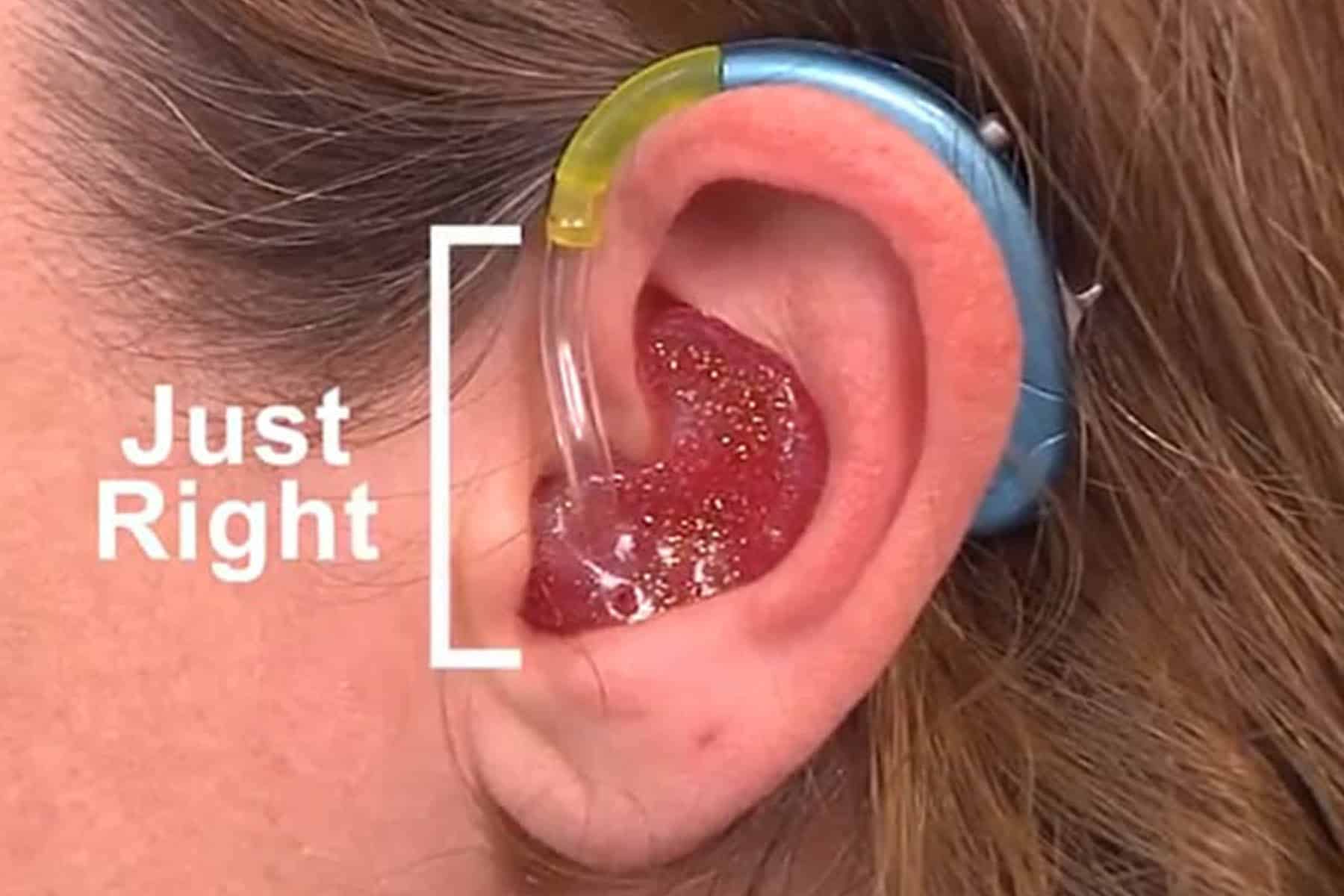 earmoldblog