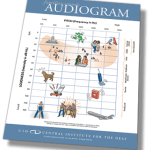 preview CID audiogram