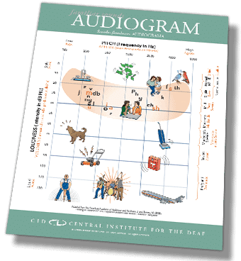 preview CID audiogram spanish